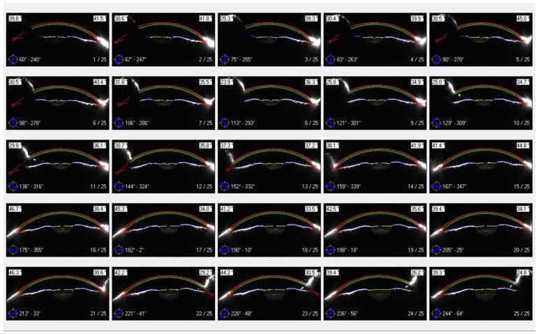 https://cdn.ncbi.nlm.nih.gov/pmc/blobs/6dd5/10886353/d2474a30e7b5/bioengineering-11-00148-g009.jpg