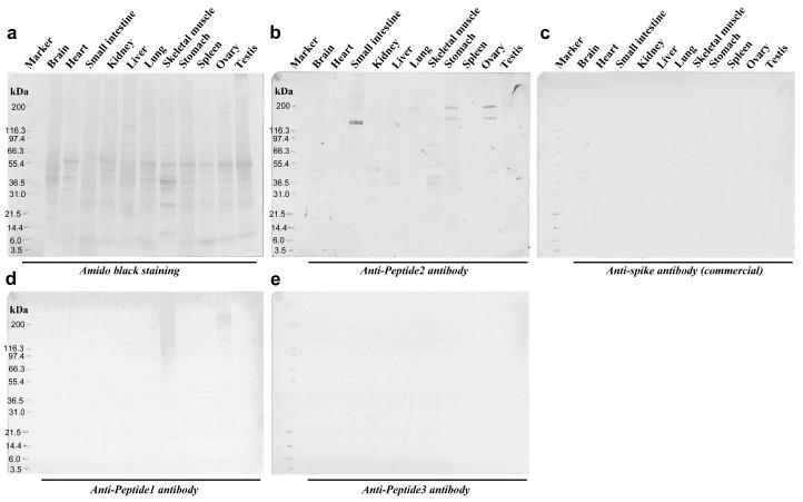 https://cdn.ncbi.nlm.nih.gov/pmc/blobs/6ddd/11125730/5b1fbfc999a8/vaccines-12-00539-g009.jpg