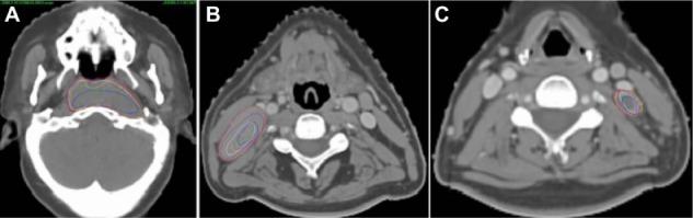 https://cdn.ncbi.nlm.nih.gov/pmc/blobs/6ddf/3839809/9063c13ee8a8/ott-6-1719Fig1.jpg