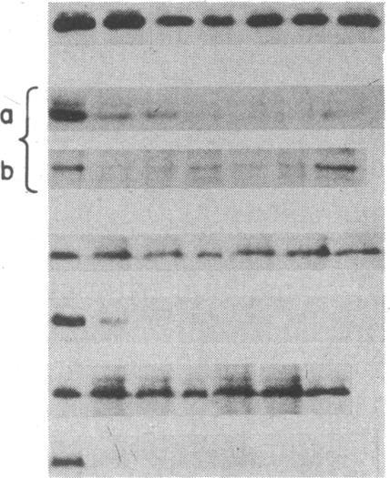 https://cdn.ncbi.nlm.nih.gov/pmc/blobs/6de5/279641/a810e91f13ce/pnas00255-0161-b.jpg