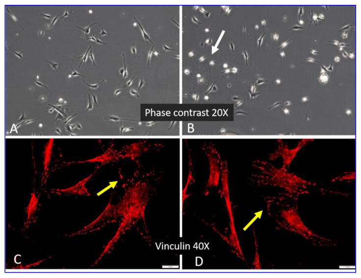 https://cdn.ncbi.nlm.nih.gov/pmc/blobs/6de6/8953637/470a98be4c74/ijms-23-03058-g002.jpg