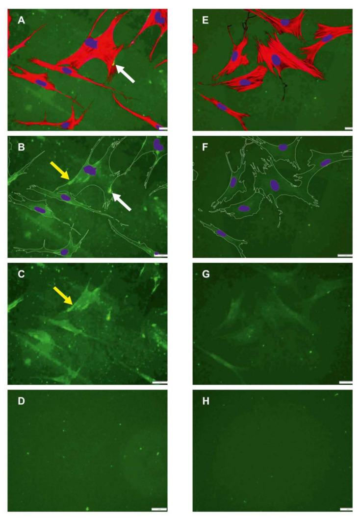 https://cdn.ncbi.nlm.nih.gov/pmc/blobs/6de6/8953637/839437d9d403/ijms-23-03058-g003.jpg