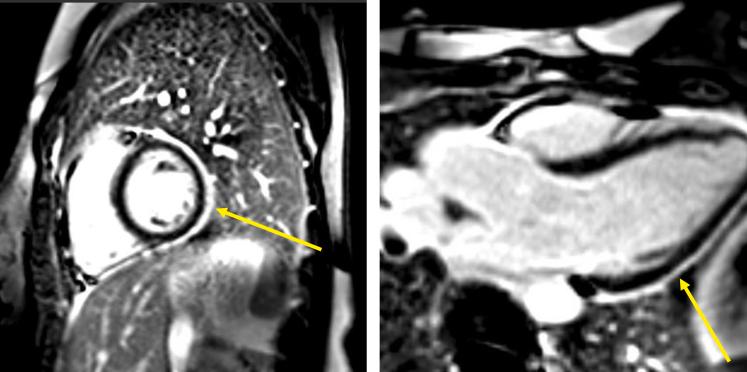 https://cdn.ncbi.nlm.nih.gov/pmc/blobs/6df5/12046815/a09bba78154f/gr1.jpg