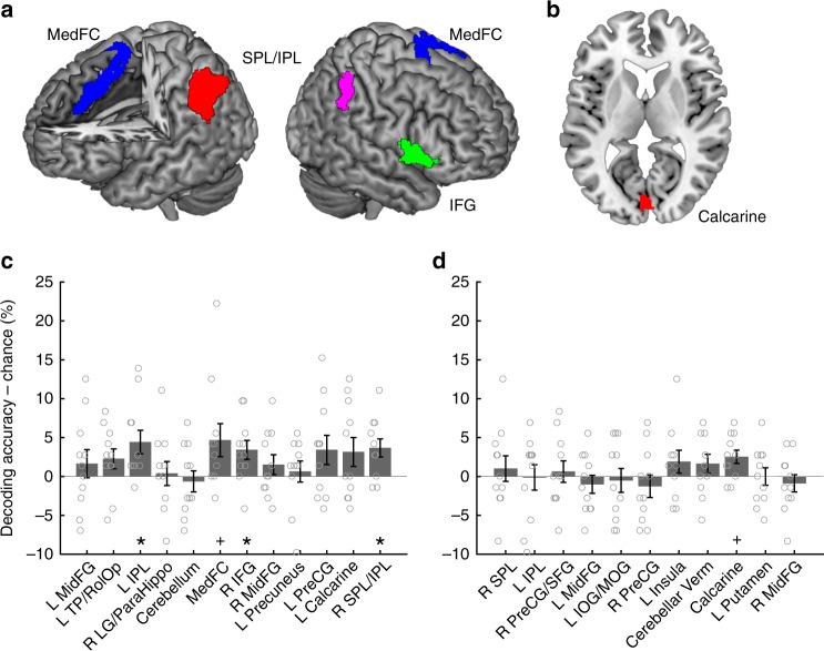 https://cdn.ncbi.nlm.nih.gov/pmc/blobs/6df5/6303258/95fdc4797102/42003_2018_243_Fig3_HTML.jpg