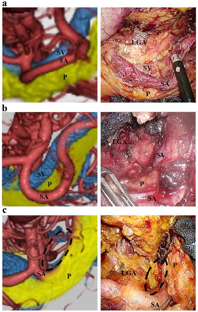 https://cdn.ncbi.nlm.nih.gov/pmc/blobs/6df7/7328210/2171648775a1/10.1177_2050312120936918-fig2.jpg