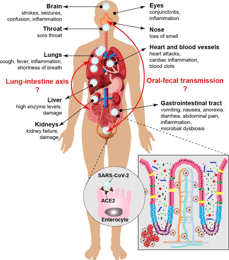 https://cdn.ncbi.nlm.nih.gov/pmc/blobs/6df8/8209355/e490dbb7fe39/gr3.jpg