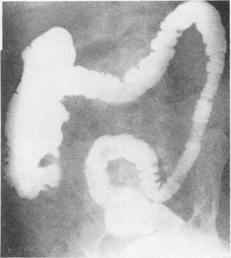 https://cdn.ncbi.nlm.nih.gov/pmc/blobs/6df9/2312254/ea4371eb534a/annrcse00254-0035-a.jpg