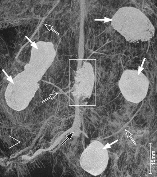 https://cdn.ncbi.nlm.nih.gov/pmc/blobs/6dfa/3034875/05ac56c4143f/330_2010_1915_Fig1_HTML.jpg