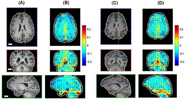https://cdn.ncbi.nlm.nih.gov/pmc/blobs/6e00/6454654/014d030ca98d/10.1177_1179069519840444-fig7.jpg