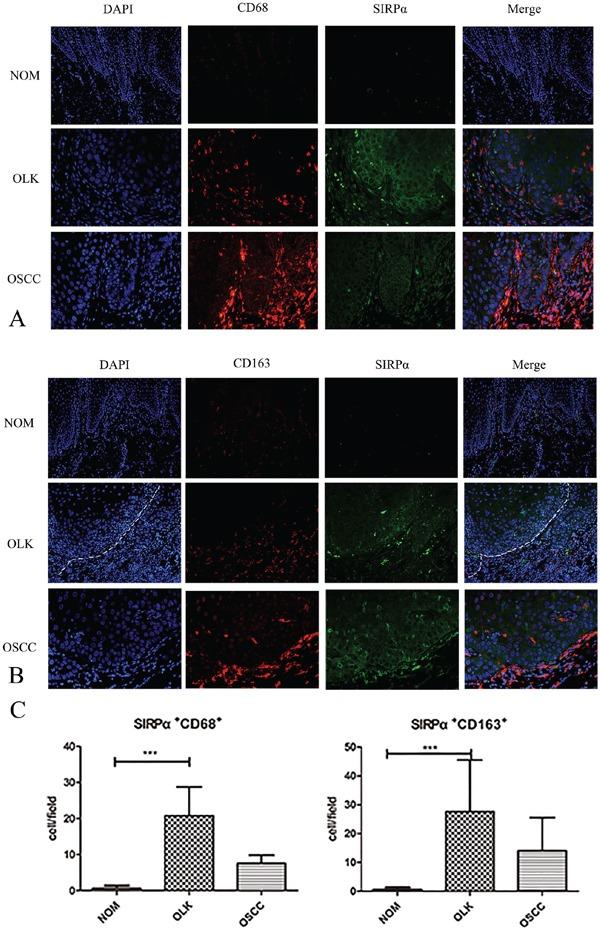 https://cdn.ncbi.nlm.nih.gov/pmc/blobs/6e05/5348394/2a2d667a3968/oncotarget-07-81305-g002.jpg