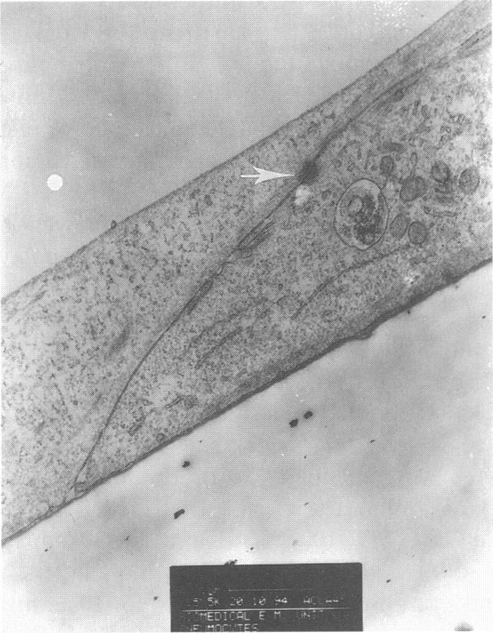 https://cdn.ncbi.nlm.nih.gov/pmc/blobs/6e08/1384007/e3df8102d01e/immunology00063-0130-b.jpg