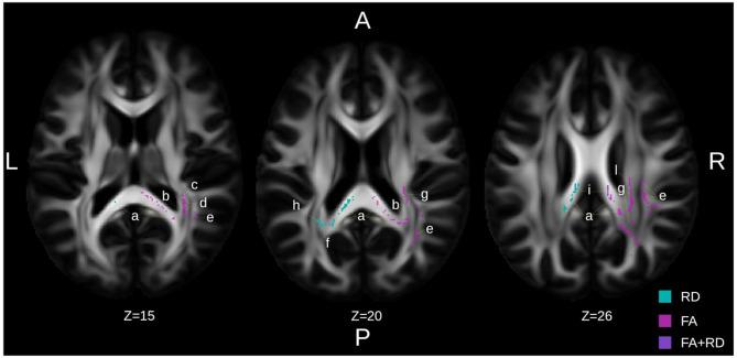 https://cdn.ncbi.nlm.nih.gov/pmc/blobs/6e09/12416070/4b6566a8bbeb/13195_2025_1835_Fig3_HTML.jpg