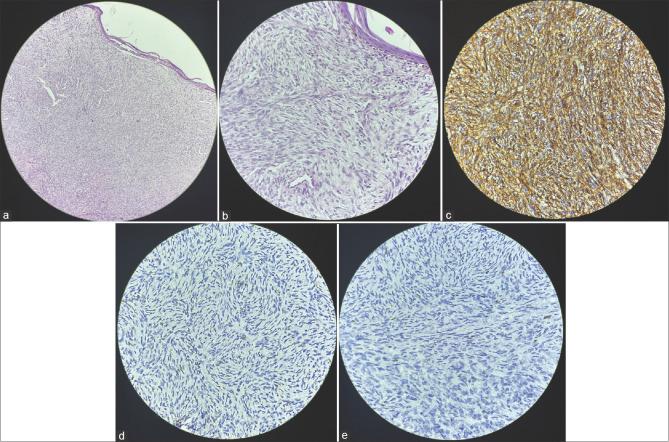 https://cdn.ncbi.nlm.nih.gov/pmc/blobs/6e11/10231697/45859d96842c/IDOJ-14-445-g002.jpg