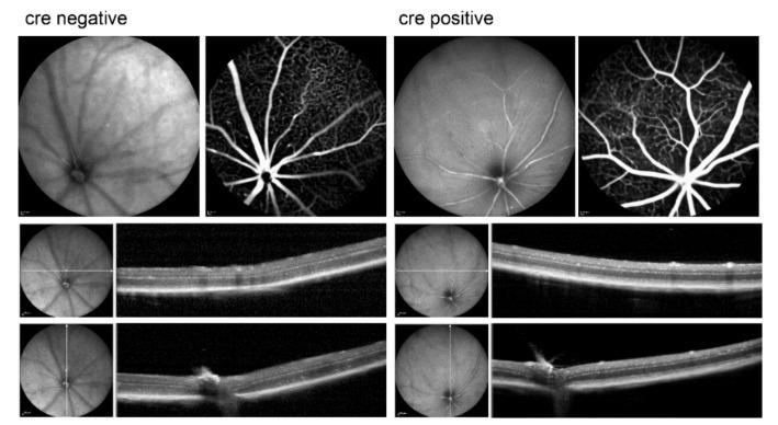 https://cdn.ncbi.nlm.nih.gov/pmc/blobs/6e19/8158494/4c625501e9b8/ijms-22-05321-g007.jpg