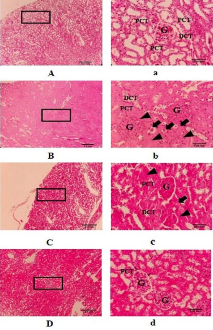https://cdn.ncbi.nlm.nih.gov/pmc/blobs/6e1b/11266743/e716f6782551/IJBMS-27-1162-g007.jpg