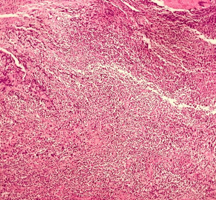 https://cdn.ncbi.nlm.nih.gov/pmc/blobs/6e1b/12057527/d3a8b3b237ef/cureus-0017-00000081828-i02.jpg