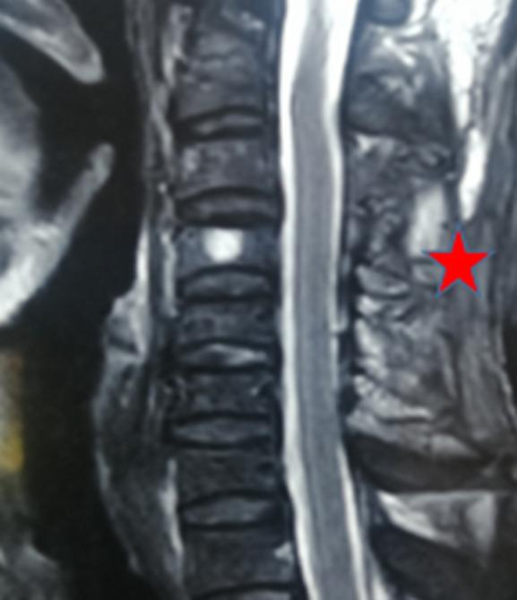 https://cdn.ncbi.nlm.nih.gov/pmc/blobs/6e27/9674530/7a63c228a9da/PAMJ-43-12-g002.jpg