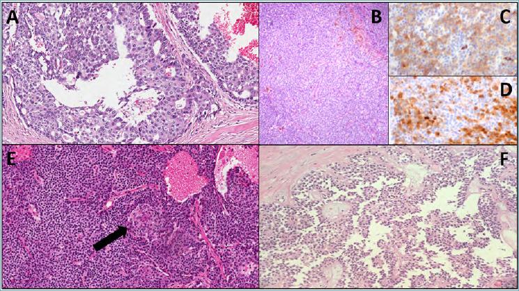 https://cdn.ncbi.nlm.nih.gov/pmc/blobs/6e29/7931574/0b61cc681741/pathol-2020-03-210-g004.jpg