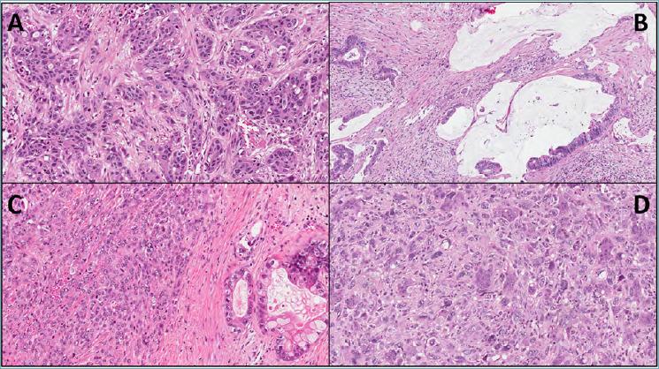 https://cdn.ncbi.nlm.nih.gov/pmc/blobs/6e29/7931574/19bb35cbd661/pathol-2020-03-210-g003.jpg