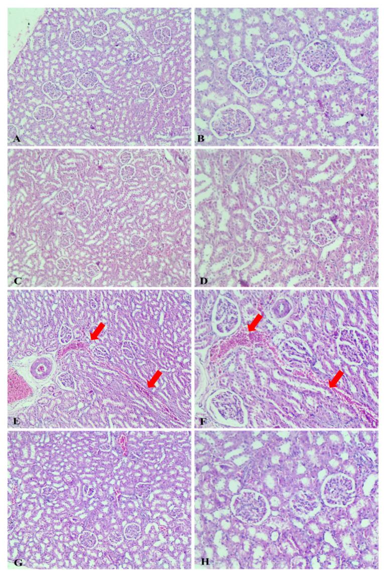 https://cdn.ncbi.nlm.nih.gov/pmc/blobs/6e2b/11641252/8d920b2b16b7/ijms-25-13024-g008.jpg