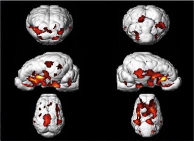 https://cdn.ncbi.nlm.nih.gov/pmc/blobs/6e2b/4473270/7bd8f2cfd6f8/gr4.jpg