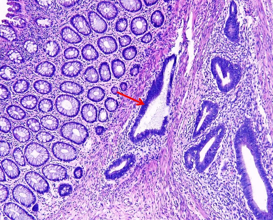 https://cdn.ncbi.nlm.nih.gov/pmc/blobs/6e30/9260976/754345ff6d43/12905_2022_1858_Fig3_HTML.jpg