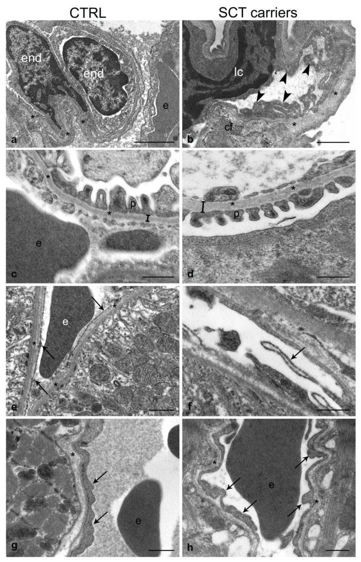 https://cdn.ncbi.nlm.nih.gov/pmc/blobs/6e33/10341605/7ee6ce966f53/ijms-24-10452-g004.jpg