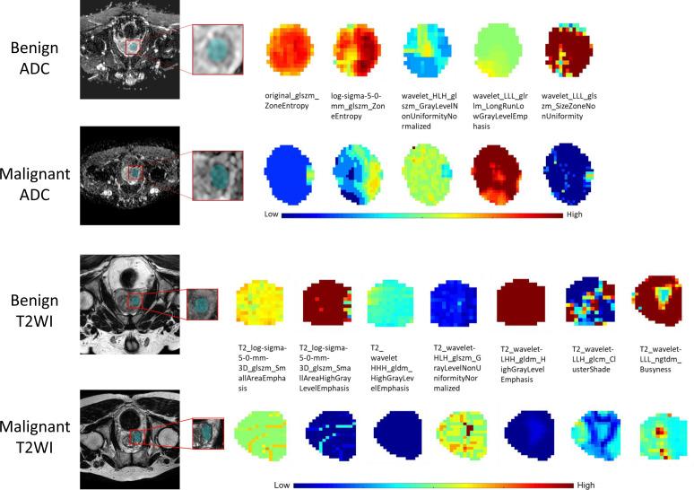https://cdn.ncbi.nlm.nih.gov/pmc/blobs/6e37/9793773/4c14515e3efc/fonc-12-1020317-g004.jpg