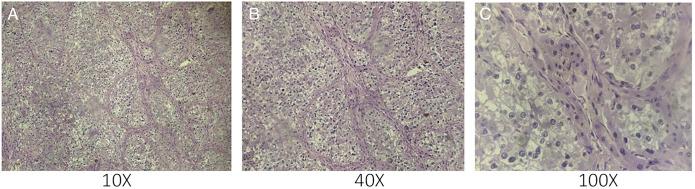 https://cdn.ncbi.nlm.nih.gov/pmc/blobs/6e4d/9857397/1aa184a83026/ac9-10-e00962-g004.jpg