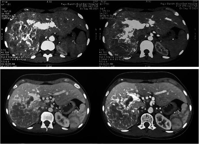 https://cdn.ncbi.nlm.nih.gov/pmc/blobs/6e4d/9857397/421b77a754d6/ac9-10-e00962-g001.jpg