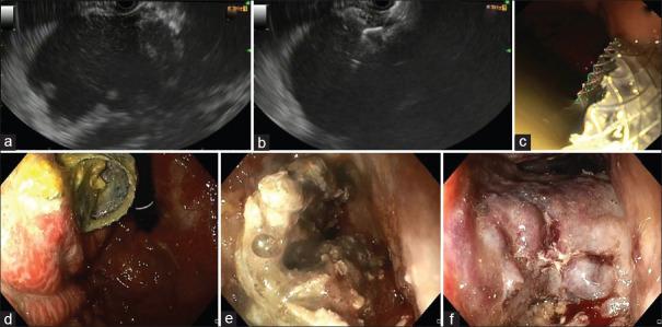 https://cdn.ncbi.nlm.nih.gov/pmc/blobs/6e55/12404420/731ab32f0fdd/SMJ-66-420-g002.jpg