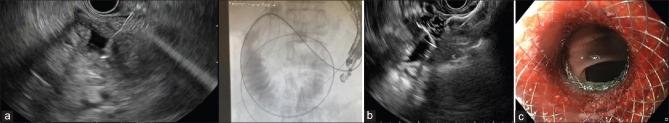 https://cdn.ncbi.nlm.nih.gov/pmc/blobs/6e55/12404420/8a4a145d8a36/SMJ-66-420-g005.jpg