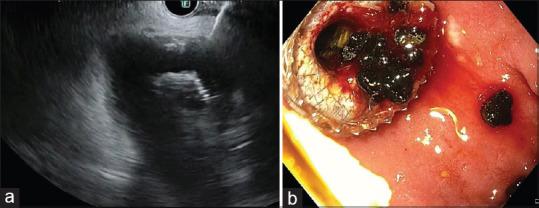 https://cdn.ncbi.nlm.nih.gov/pmc/blobs/6e55/12404420/95ab3c04bf60/SMJ-66-420-g003.jpg