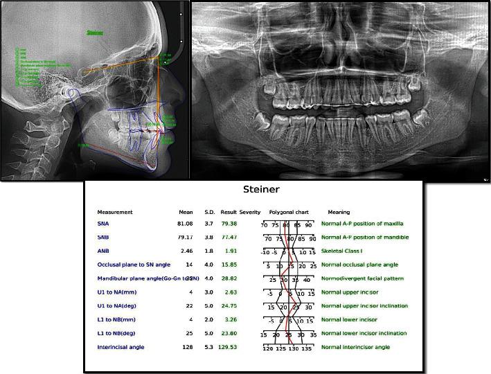 https://cdn.ncbi.nlm.nih.gov/pmc/blobs/6e5c/8342153/da17d2a9cac9/CRID2021-4285330.006.jpg