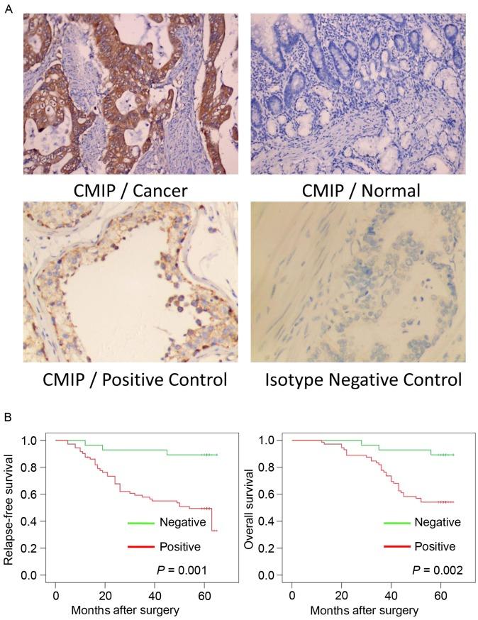 https://cdn.ncbi.nlm.nih.gov/pmc/blobs/6e62/5865856/f3ceb6a136fc/mmr-16-05-7277-g00.jpg