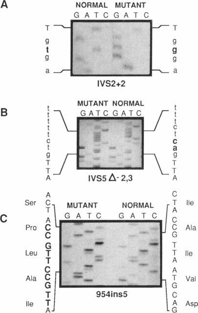 https://cdn.ncbi.nlm.nih.gov/pmc/blobs/6e64/1682507/7904e9cd62a1/ajhg00057-0034-b.jpg