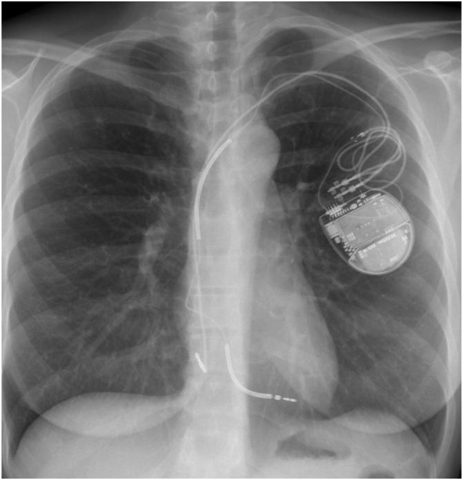 https://cdn.ncbi.nlm.nih.gov/pmc/blobs/6e69/9596365/796985956274/gr2.jpg