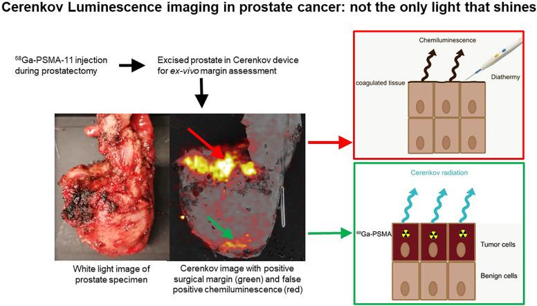 https://cdn.ncbi.nlm.nih.gov/pmc/blobs/6e6a/8717187/ed7e252e6fe7/jnumed.120.260034absf1.jpg