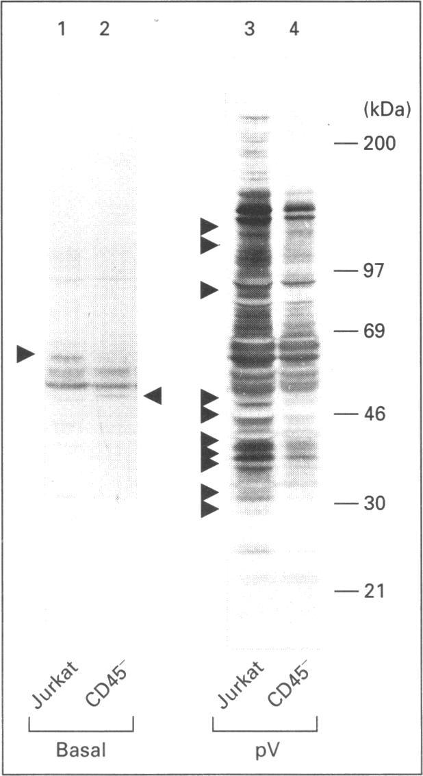 https://cdn.ncbi.nlm.nih.gov/pmc/blobs/6e6b/1137806/10355d0cdc2b/biochemj00096-0163-b.jpg