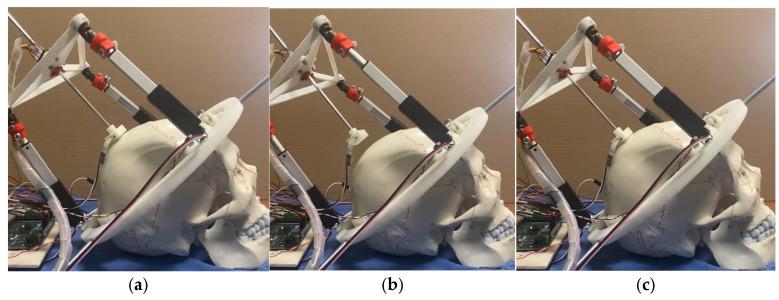 https://cdn.ncbi.nlm.nih.gov/pmc/blobs/6e76/12190415/6cac7b69b337/biomimetics-10-00345-g015.jpg