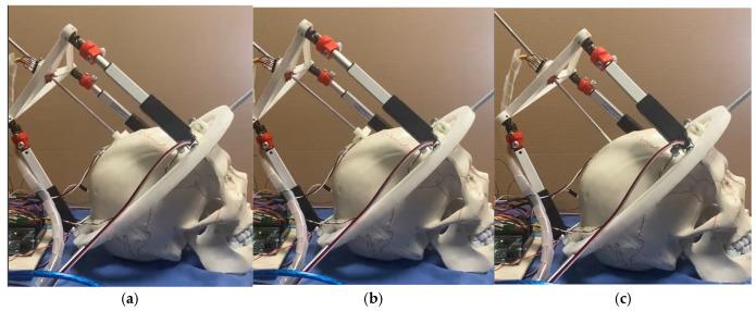 https://cdn.ncbi.nlm.nih.gov/pmc/blobs/6e76/12190415/882b161db798/biomimetics-10-00345-g009.jpg