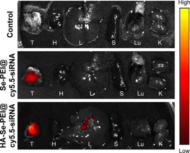 https://cdn.ncbi.nlm.nih.gov/pmc/blobs/6e77/5858822/2b5c66331018/ijn-13-1539Fig7.jpg