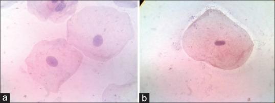 https://cdn.ncbi.nlm.nih.gov/pmc/blobs/6e78/5596672/323db83c0dbb/JOMFP-21-224-g003.jpg