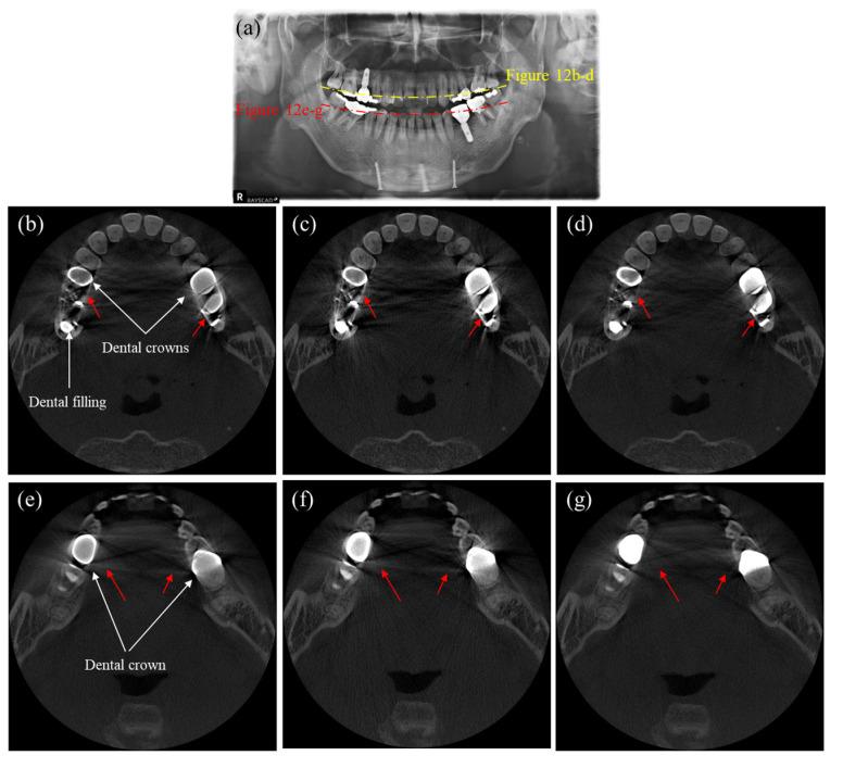 https://cdn.ncbi.nlm.nih.gov/pmc/blobs/6e7a/9919069/7a6e8de8b199/sensors-23-01288-g012.jpg