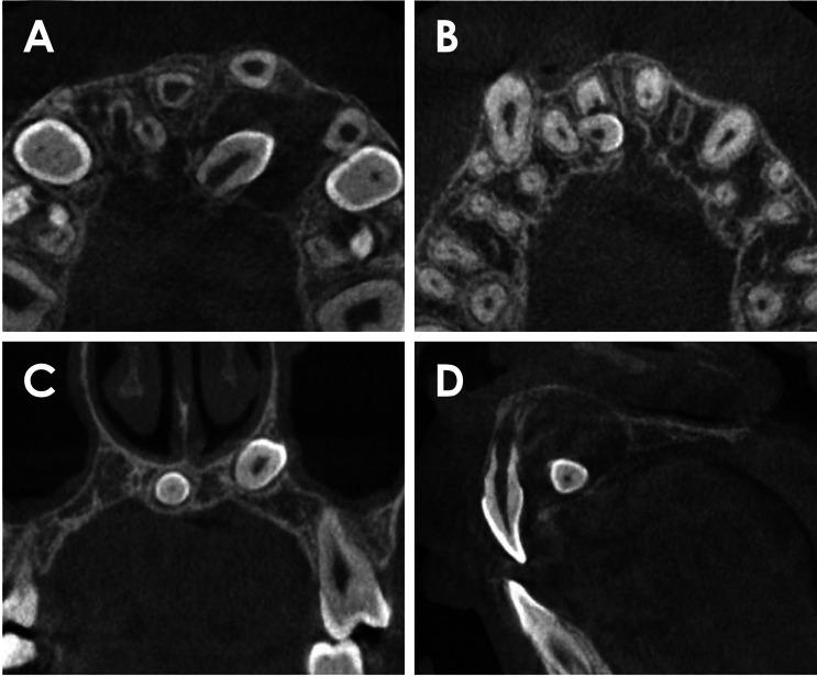 https://cdn.ncbi.nlm.nih.gov/pmc/blobs/6e80/8967489/73545cba8520/isd-52-67-g002.jpg