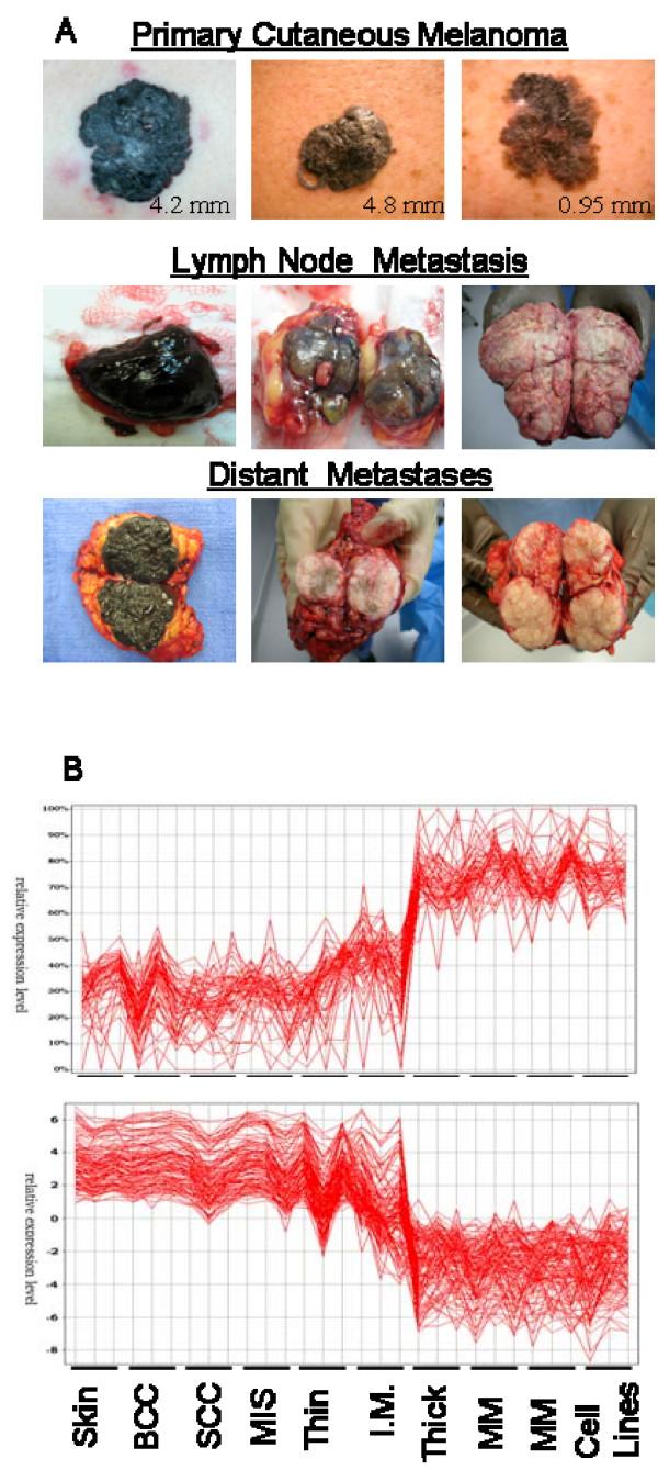 https://cdn.ncbi.nlm.nih.gov/pmc/blobs/6e87/2408576/39a77017ce23/1755-8794-1-13-1.jpg
