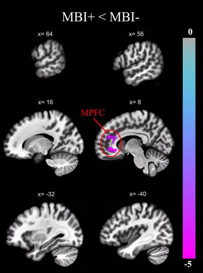 https://cdn.ncbi.nlm.nih.gov/pmc/blobs/6e87/9847513/a4e9be69d1a5/TRC2-9-e12371-g002.jpg