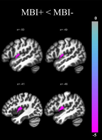 https://cdn.ncbi.nlm.nih.gov/pmc/blobs/6e87/9847513/c76ff660ca31/TRC2-9-e12371-g001.jpg