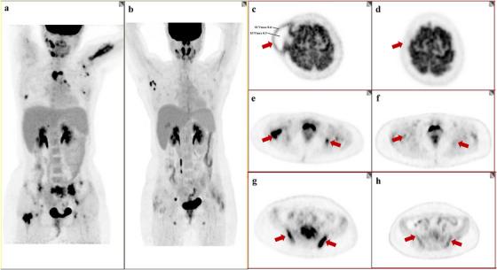 https://cdn.ncbi.nlm.nih.gov/pmc/blobs/6e8b/12109469/3e6499295945/JHA2-6-e70067-g001.jpg