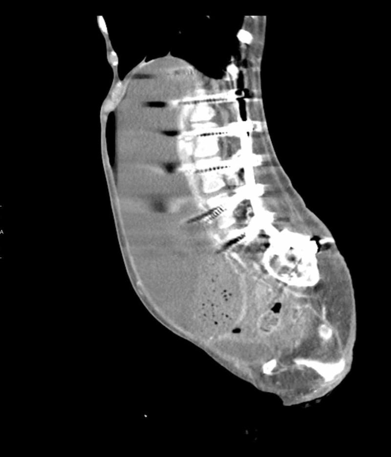 https://cdn.ncbi.nlm.nih.gov/pmc/blobs/6e98/6609291/47ebd52f079b/cureus-0011-00000004609-i01.jpg